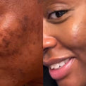 Palesa T.